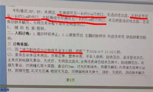 江西安福一乡长下乡时遭人刺伤遇害，家属：事发9月7日，抢救8天后离世